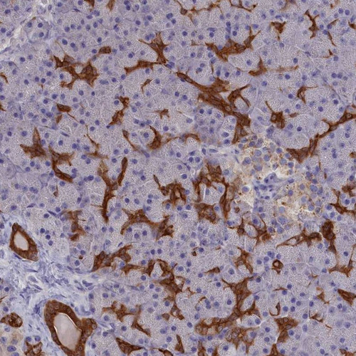 Immunohistochemical staining of human pancreas shows strong cytoplasmic and membranous positivity in ducts.