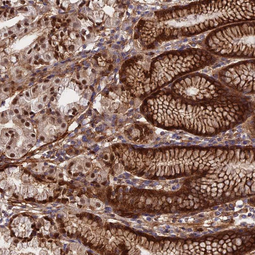 Immunohistochemical staining of human stomach, lower shows distinct cytoplasmic, membranous and nuclear positivity in glandular cells.
