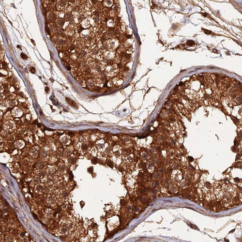 Immunohistochemical staining of human testis shows nuclear and cytoplasmic positivity in cells in seminiferous ducts.
