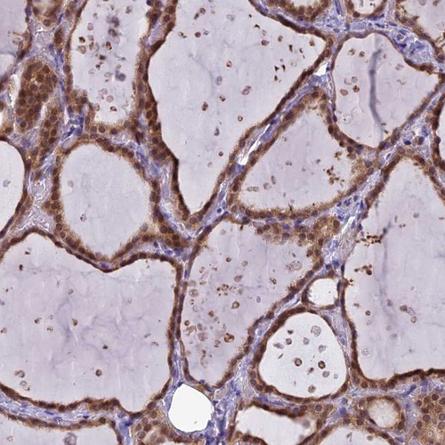 Immunohistochemical staining of human thyroid gland shows moderate cytoplasmic and nuclear positivity in glandular cells.