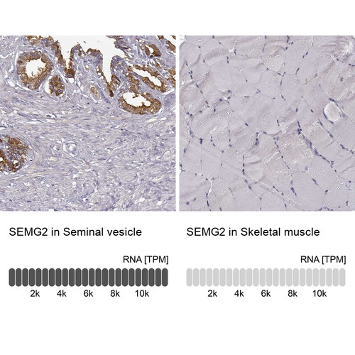 Immunohistochemistry analysis in human seminal vesicle and skeletal muscle tissues using Anti-SEMG2 antibody. Corresponding SEMG2 RNA-seq data are presented for the same tissues.