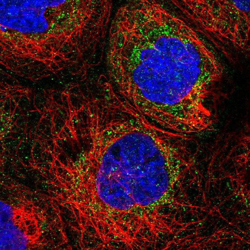 Immunofluorescent staining of human cell line A-431 shows localization to mitochondria.