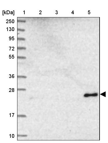 Lane 1: Marker [kDa] 250, 130, 95, 72, 55, 36, 28, 17, 10<br/>Lane 2: Human cell line RT-4<br/>Lane 3: Human cell line U-251MG sp<br/>Lane 4: Human plasma (IgG/HSA depleted)<br/>Lane 5: Human liver tissue