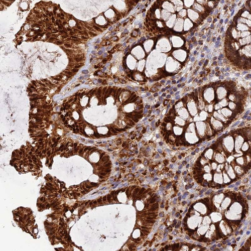 Immunohistochemical staining of human colon shows strong cytoplasmic and nuclear positivity in glandular cells.