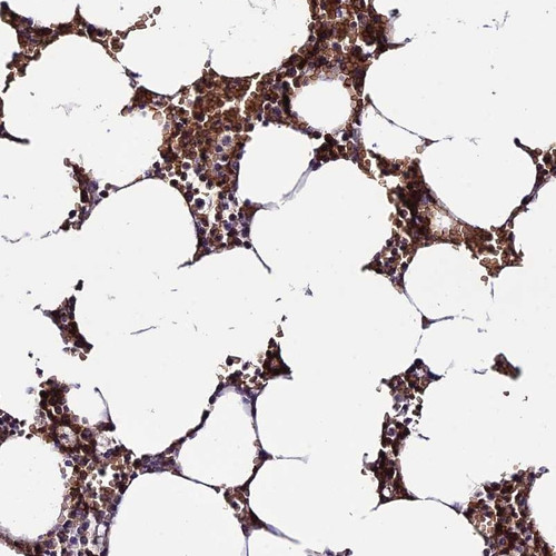 Immunohistochemical staining of human bone marrow shows strong cytoplasmic positivity in hematopoietic cells.