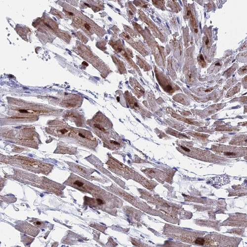 Immunohistochemical staining of human heart muscle shows cytoplasmic positivity in myocytes.