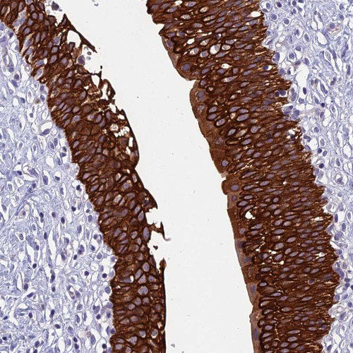 Immunohistochemical staining of human urinary bladder shows strong cytoplasmic and membranous positivity in urothelial cells.