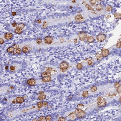 Immunohistochemical staining of human duodenum shows strong cytoplasmic positivity in glandular cells.