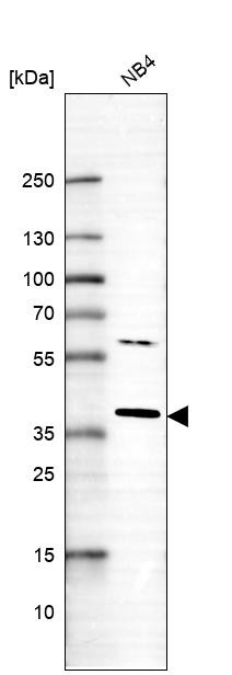 Western blot analysis in control (vector only transfected HEK293T lysate) and RNF166 over-expression lysate (Co-expressed with a C-terminal myc-DDK tag (~3.1 kDa) in mammalian HEK293T cells, LY405857).