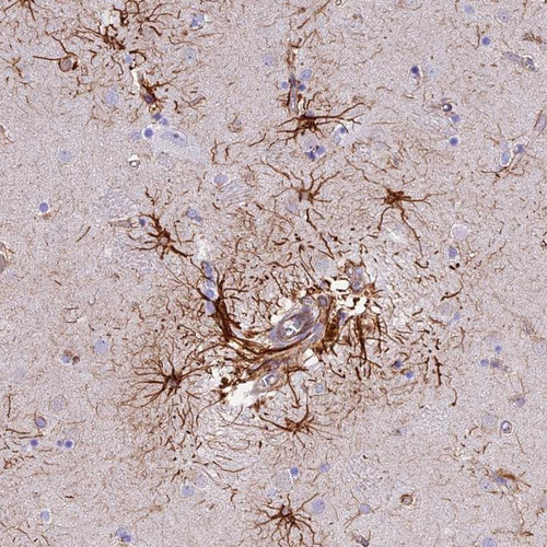 Immunohistochemical staining of human caudate shows distinct positivity in astrocytes.