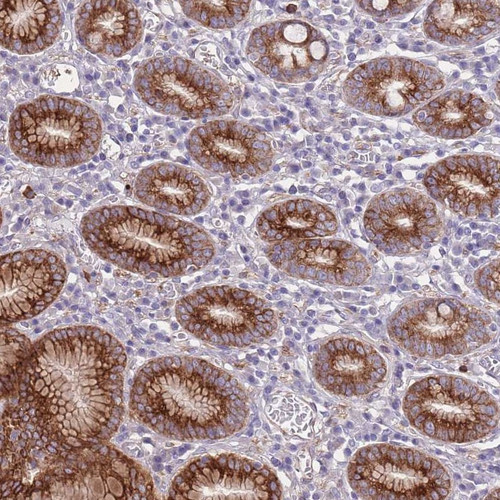 Immunohistochemical staining of human stomach, lower shows strong cytoplasmic and membranous positivity in glandular cells. Immunohistochemical staining of human stomach, lower shows strong cytoplasmic and membranous positivity in glandular cells.
