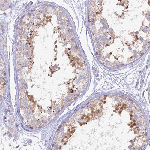 Immunohistochemical staining of human testis shows moderate nuclear positivity in spermatids.