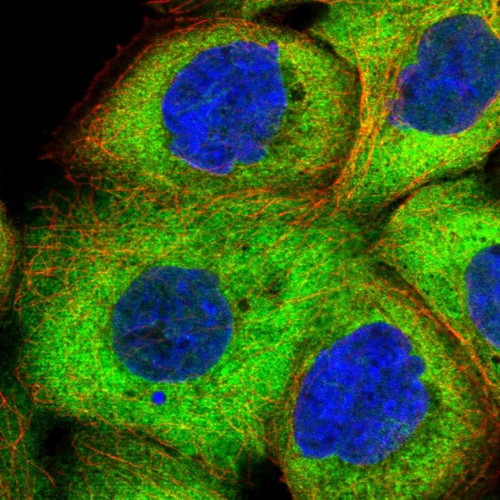 Immunofluorescent staining of human cell line A-431 shows localization to cytosol.