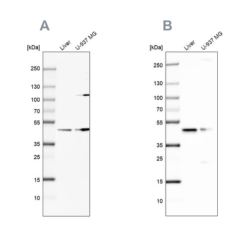 Western blot analysis using Anti-GCDH antibody HPA043252 (A) shows similar pattern to independent antibody HPA048492 (B).
