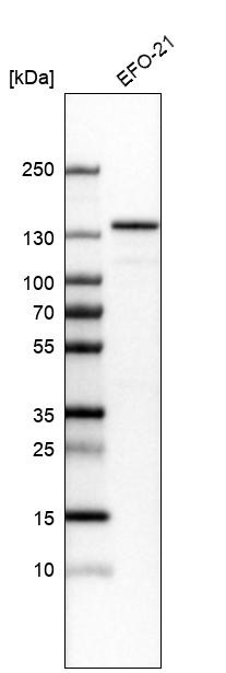 Western blot analysis in human cell line EFO-21.