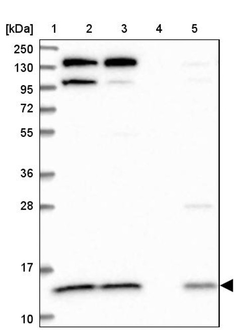 Lane 1: Marker [kDa] 250, 130, 95, 72, 55, 36, 28, 17, 10<br/>Lane 2: Human cell line RT-4<br/>Lane 3: Human cell line U-251MG sp<br/>Lane 4: Human plasma (IgG/HSA depleted)<br/>Lane 5: Human liver tissue