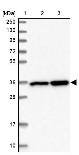 Lane 1: Marker [kDa] 250, 130, 95, 72, 55, 36, 28, 17, 10<br/>Lane 2: Human cell line RT-4<br/>Lane 3: Human cell line U-251MG sp