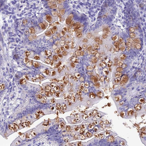 Immunohistochemical staining of human small intestine shows moderate cytoplasmic positivity in goblet cells of glandular cells.