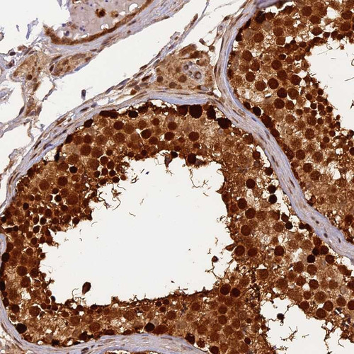 Immunohistochemical staining of human testis shows strong cytoplasmic and nuclear positivity in cells in seminiferus ducts.