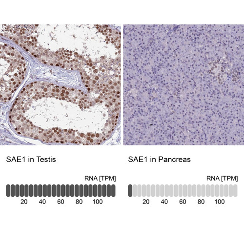Immunohistochemistry analysis in human testis and pancreas tissues using Anti-SAE1 antibody. Corresponding SAE1 RNA-seq data are presented for the same tissues.