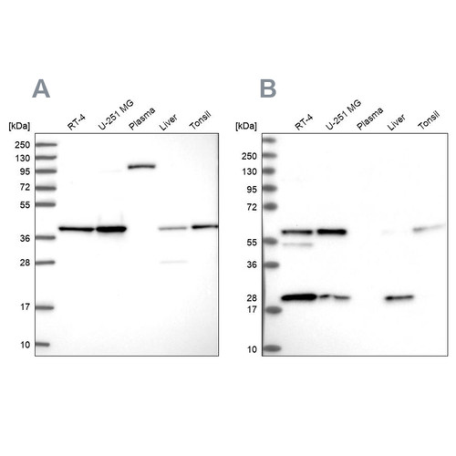 Western blot analysis using Anti-SAE1 antibody HPA043552 (A) shows similar pattern to independent antibody HPA041906 (B).