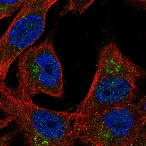 Immunofluorescent staining of human cell line SK-MEL-30 shows localization to the Golgi apparatus.