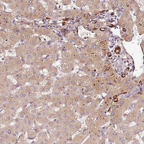 Immunohistochemical staining of human liver shows distinct cytoplasmic positivity in hepatocytes.