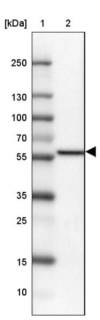 Lane 1: Marker [kDa] 250, 130, 100, 70, 55, 35, 25, 15, 10<br/>Lane 2: Human cell line U-87 MG
