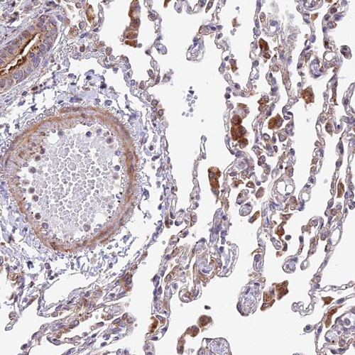 Immunohistochemical staining of human lung shows moderate cytoplasmic positivity in macrophages.
