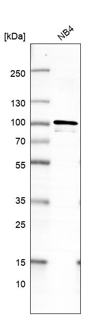 Lane 1: Marker [kDa] 250, 130, 95, 72, 55, 36, 28, 17, 10<br/>Lane 2: Human cell line RT-4