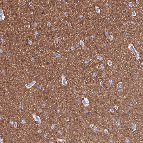 Immunohistochemical staining of human cerebral cortex shows moderate cytoplasmic positivity in neuropil.