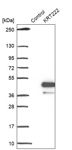 Western blot analysis in control (vector only transfected HEK293T lysate) and KRT222 over-expression lysate (Co-expressed with a C-terminal myc-DDK tag (~3.1 kDa) in mammalian HEK293T cells, LY407599).