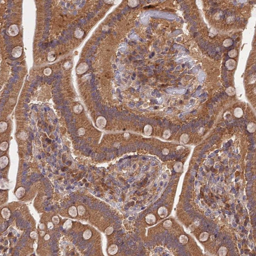 Immunohistochemical staining of human duodenum shows strong cytoplasmic positivity in glandular cells.