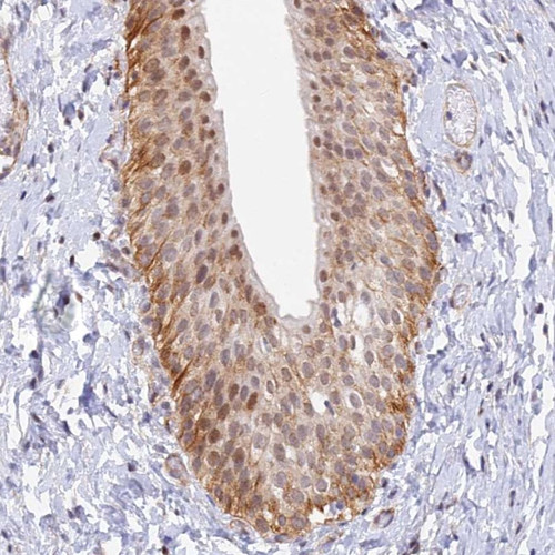 Immunohistochemical staining of human urinary bladder shows moderate cytoplasmic and nuclear positivity in urothelial cells.
