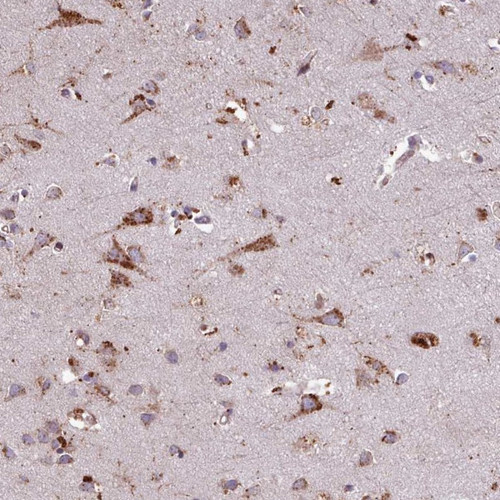 Immunohistochemical staining of human cerebral cortex shows strong cytoplasmic positivity in neuronal and glial cells. 