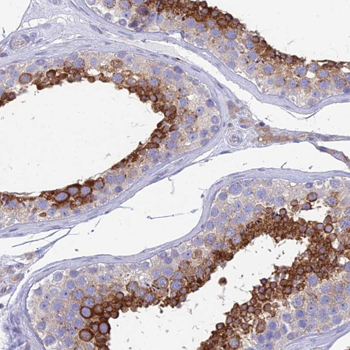Immunohistochemical staining of human testis shows strong cytoplasmic positivity in cells of seminiferous ducts..