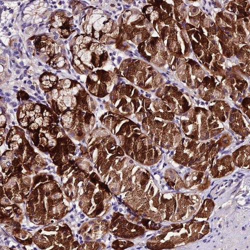 Immunohistochemical staining of human stomach, upper shows strong cytoplasmic positivity in glandular cells.