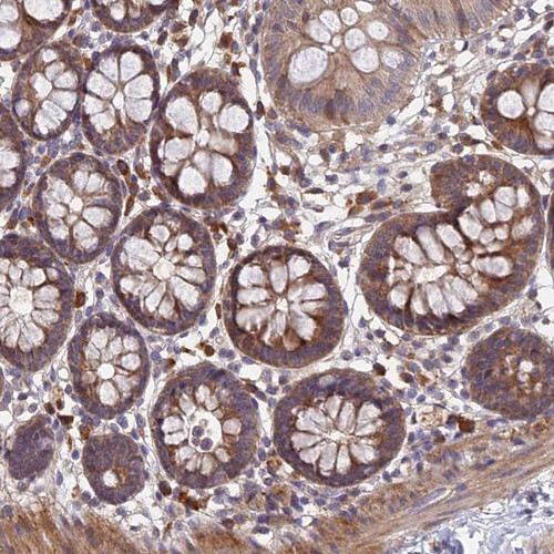 Immunohistochemical staining of human colon shows moderate cytoplasmic positivity in glandular cells.