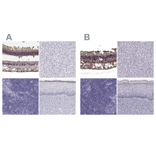 Immunohistochemical staining of human eye, retina, liver, lymphoid tissues and squamous epithelia using Anti-RLBP1 antibody HPA044083 (A) shows similar protein distribution across tissues to independent antibody HPA042051 (B).