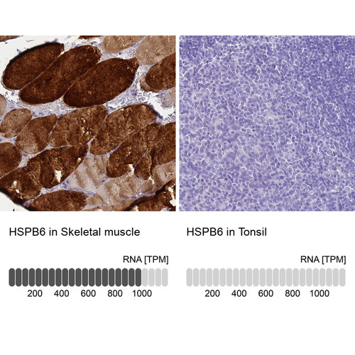 Immunohistochemistry analysis in human skeletal muscle and tonsil tissues using Anti-HSPB6 antibody. Corresponding HSPB6 RNA-seq data are presented for the same tissues.