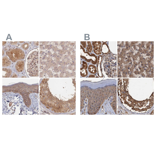 Immunohistochemical staining of human kidney, liver, skin and testis using Anti-PSMD9 antibody HPA044220 (A) shows similar protein distribution across tissues to independent antibody HPA040512 (B).