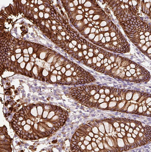 Immunohistochemical staining of human colon shows strong membranous positivity in glandular cells.