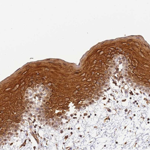 Immunohistochemical staining of human oral mucosa shows strong cytoplasmic and nuclear positivity in squamous epithelial cells.
