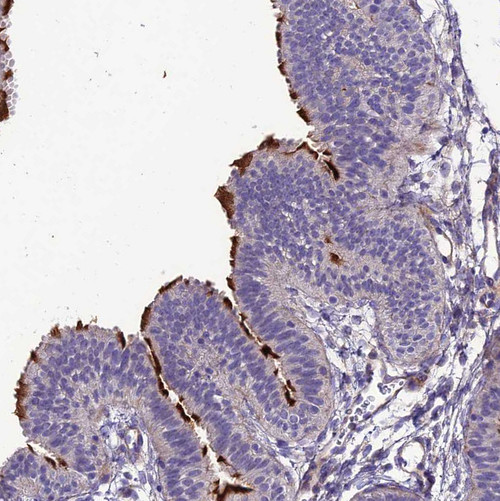 Immunohistochemical staining of human Fallopian tube shows strong positivity in cilia in glandular cells.