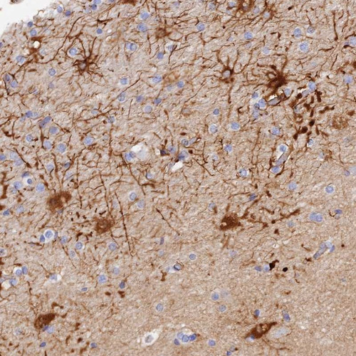 Immunohistochemical staining of human cerebral cortex shows moderate cytoplasmic positivity in neuronal cells.