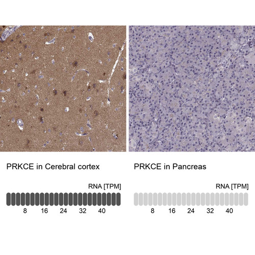Immunohistochemistry analysis in human cerebral cortex and pancreas tissues using HPA044496 antibody. Corresponding PRKCE RNA-seq data are presented for the same tissues.