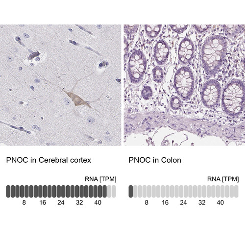 Immunohistochemistry analysis in human cerebral cortex and colon tissues using Anti-PNOC antibody. Corresponding PNOC RNA-seq data are presented for the same tissues.