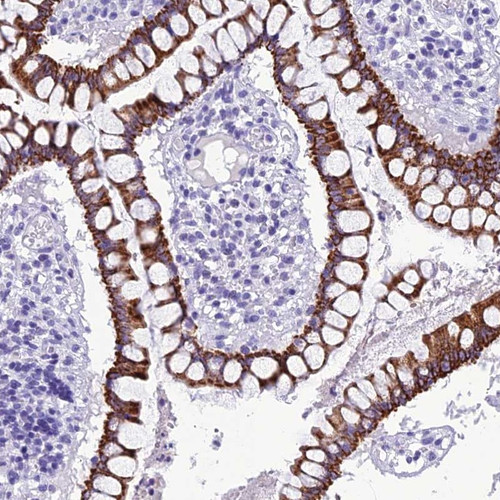 Immunohistochemical staining of human colon shows strong cytoplasmic positivity in glandular cells.