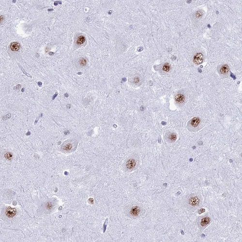 Immunohistochemical staining of human hippocampus shows moderate nuclear positivity in neuronal cells.