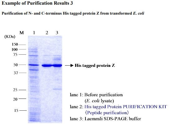 His tagged Protein PURIFICATION KIT [Catalog No.: MBL-3310,MBL-3310A]